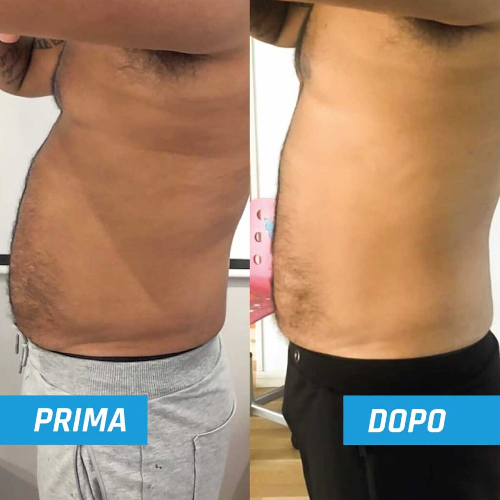 prima-dopo3